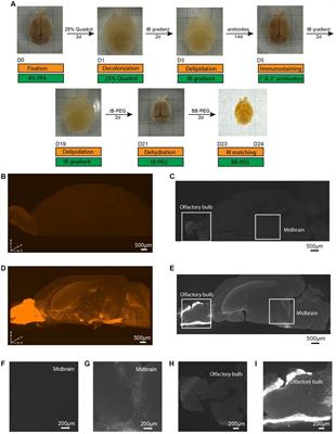 Immunolabeling-compatible PEGASOS tissue clearing for high-resolution whole mouse brain imaging